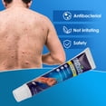 thumbnail image 1 of Crema Antiprurítica Para Urticaria, Pomada Antipicazón, Crema Antipicazón, Crema Antipruriginosa Para Urticaria, 20g, Pomada Antipicazón A Base De Hierbas Naturales ANGGREK Anti Itch Cream, 1 of 8