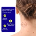 thumbnail image 3 of Pomada para eliminar verrugas, herpes genital, vulva genital, condiloma acuminado, eliminador de marcas en la piel, crema de tratamiento antibacteriano, 3 of 5