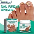 thumbnail image 2 of 1-3pcs Nail Onychomycosis Cream Feet Heeling Gray Nails Moisture Cream For Women Men Daily Nail Care, 2 of 5