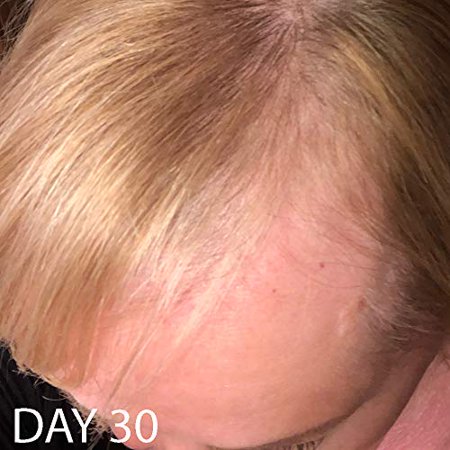 Biotin Hair Growth Shampoo Biotin Vitamin Shampoo For Hair Loss