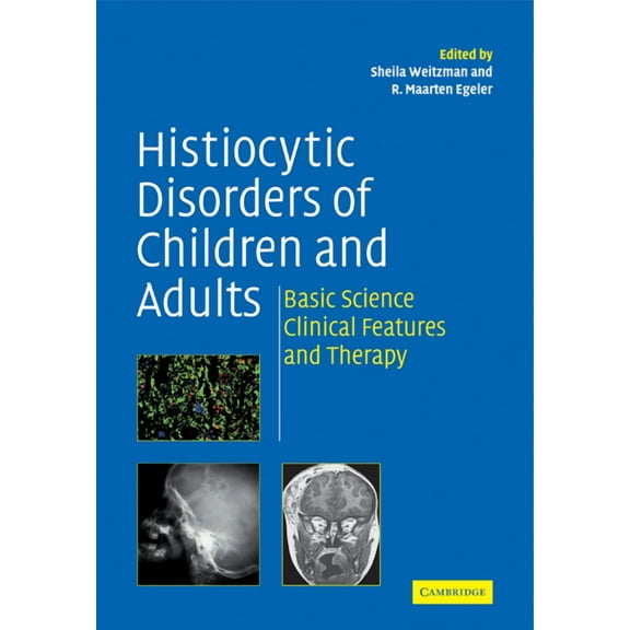 Histiocytic Disorders of Children and Adults : Basic Science, Clinical Features and Therapy (Paperback)