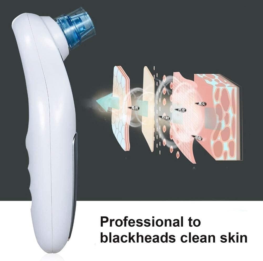 RKXQT Blackhead Remover Pore Vacuum,Electric Blackhead Suction Device, hot Compress, Pore Cleaner, Blackhead Meter, Household Beauty Instrument