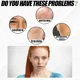 thumbnail image 4 of Crema eficaz para pecas, ilumina rápidamente la cara, elimina el Melasma, las manchas oscuras, desvanece la melanina, blanquea la pigmentación, mejora la luminosidad, 4 of 5