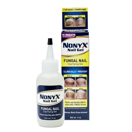 Nonyx Fungal Nail Clarifying Gel (Best Otc Toenail Fungus Treatment)