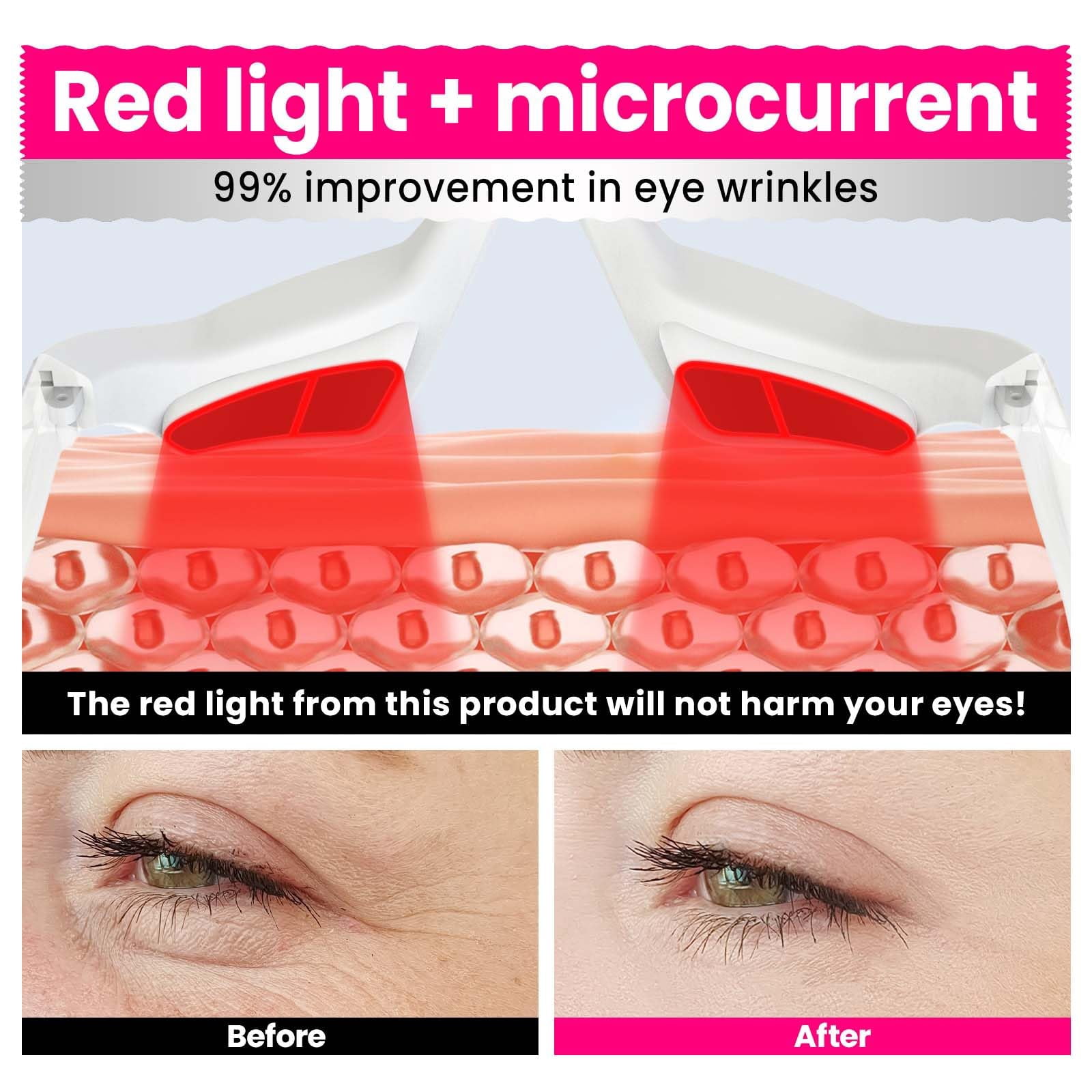 Anglink Red Light Wrinkle Therapy Glasses,Eye Massager,Microcurrent Facial Device,Used for Removing Eye Wrinkles, Relieving Eye Fatigue and Removing Dark Circles.LED Eye Perfector.