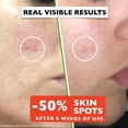 thumbnail image 3 of Serum Florence Big, eliminador de manchas oscuras antienvejecimiento con vitamina C, 60 ml, 3 of 6