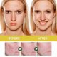 thumbnail image 3 of Jaysuing Orchid Anti-Acne Essential Oil Removes Blackheads, Acne and Pimples, Cleanses and Brightens Facial Repair Essence, 3 of 5