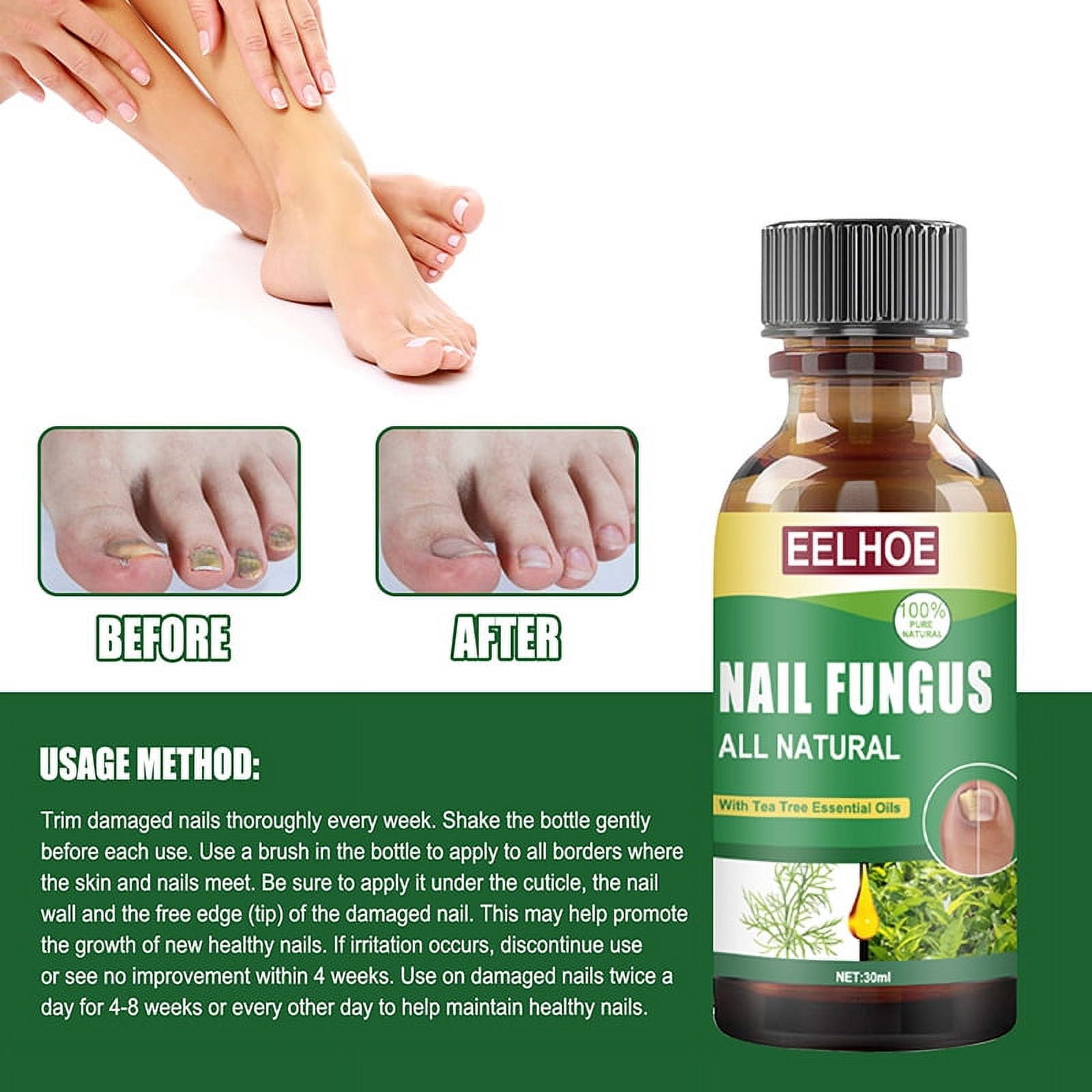 JFY Eelhoe Nail Tea Tree Oil Fungal Care Solution Onychomycosis  Antibacterial Foot Care Solution 30Ml Fungus Treatment Nail Fungus Cream  Toenail and Nail Accessories - Walmart Business Supplies