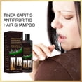 thumbnail image 2 of Champú Hair Shampoo Hair Shampoo For Tinea Capitis AntipuriticProfesional Anticaspa Elimina Los Ácaros Y Alivia El Picor Champú 100ml(Buy 2 Save 10%), 2 of 8