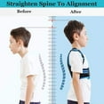 thumbnail image 5 of Back Brace Posture Corrector for Kids, Back Straightener Posture Corrector, Scoliosis and Hunchback Correction, Under Clothes Adjustable Upper Back Posture Brace for Teens, Spinal Supportor, Blue, L, 5 of 14