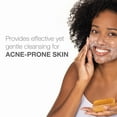 thumbnail image 4 of Neutrogena Acne Face Wash Bar, Acne Treatment for Acne-Prone Skin, Facial Cleanser, 3.5 oz, 4 of 9