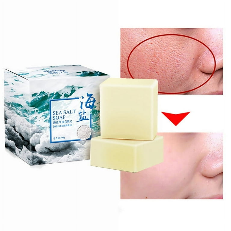 Pimple on sale clear soap