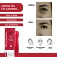 thumbnail image 2 of Skincyclopedia Under Eye Roll-On with Retinol & Squalane, Cooling Roller, Energizing Serum for Dark Circles, Puffiness Bags, Fine Lines & Wrinkles, Firms & Brightens Skin., 2 of 7