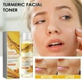thumbnail image 6 of Under $5, Toner For Dark Turmeric Dark Corrector Toner Facial Toner For Prone Skin Dark Remover For Face Hydrating Face Toner For Women 100ml, 6 of 8