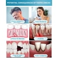 thumbnail image 4 of Pasta de dientes CAREDO Healing Teeth Crack Repair 100g, 4 of 7