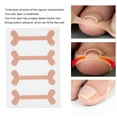 thumbnail image 5 of XIRQI 2026 New 9Pcs Ingrown Toenail Sticker,Embedded Toenail Correction Tool,Practical Light Weight,Non-Woven Fabric,Stainless Steel Ingrown Nail Corrector, 5 of 7