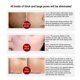 thumbnail image 3 of LANBENA 24K oro ácido hialurónico seis péptidos suero suero antienvejecimiento yeacher Suero de ácido hialurónico, 3 of 7