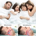 thumbnail image 3 of Anti Snoring Mouthpiece - AdjustableAnti Snoring Device - Anti Snoring Mouth Guard Helps Stop Snoring - Comfortable Snoring Solution for Men/Women Night's Sleep., 3 of 9