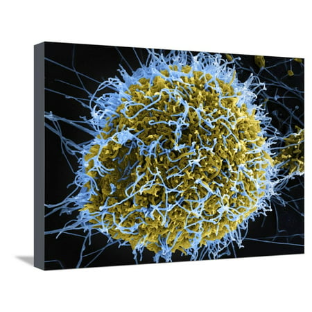 Colorized Scanning Electron Micrograph of Filamentous Ebola Virus Particles Stretched Canvas Print Wall Art By Stocktrek