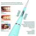thumbnail image 3 of Teeth Cleaning Kit Dental Cleaner Tool, Rechargeable Plaque Remover For Teeth, 3 of 5