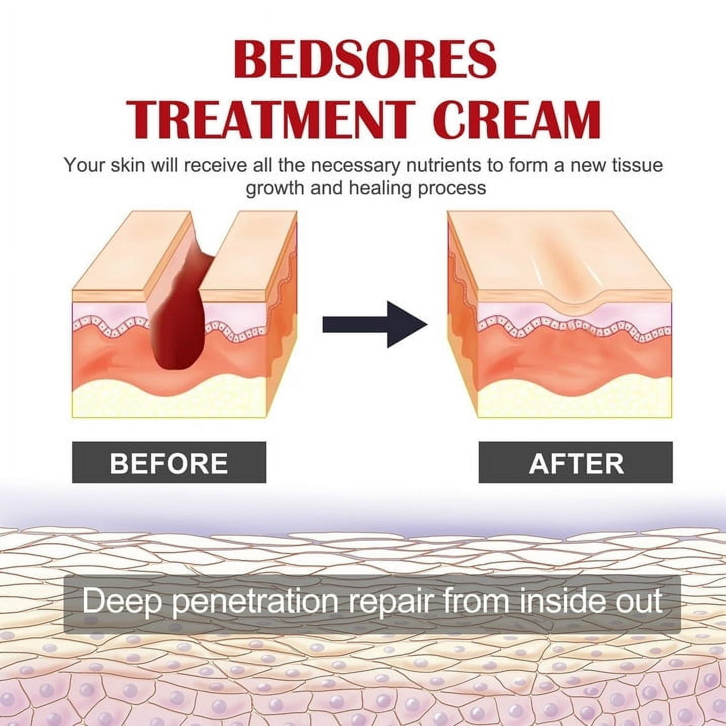 Decubitus Cream Pressure Sore Ulcer Skin Relief Ointment Bed Sore Wound Healing Treat Anti Dry Repair Moisturizing Body Care 20g