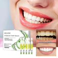 thumbnail image 1 of 1pc Teeth Whitening Essence Cleans Tooth Stains Mouth Odor Beautiful Teeth Brightening Teeth Cleaning Essence, 1 of 4