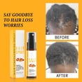 thumbnail image 2 of Aceite capilar Batana de Essences Skin Care, suero en spray natural Batana, repara los daños, reduce las puntas abiertas, apto para hombres y mujeres, suero capilar para todo tipo de cabello 1,02 fl.o, 2 of 6