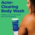 thumbnail image 5 of (2 pack) Differin Acne-Clearing Body Wash with 2% Salicylic Acid, Cream-to-Lather Cleanser, Back & Chest Acne Treatment, Daily Use, 10 oz​, 5 of 9
