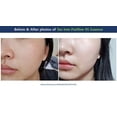 thumbnail image 4 of Sérum facial Dr. Ceuracle de leegeehaam Tea Tree Purifine 50 ml, 4 of 9