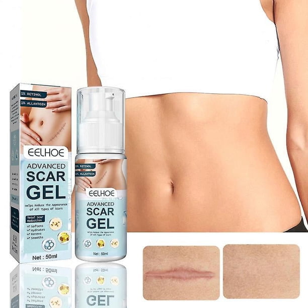 Gel para atenuar cicatrices, crema reparadora de la piel quirúrgica, terapia avanzada para cicatrices en cirugías, cesáreas, queloides, lesiones, quemaduras, suavizado de cicatrices