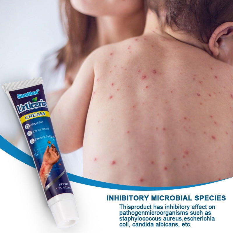 Buy Eczema Therapy Cream, Maximum Strength Treatment Ointment for Rash