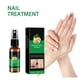 thumbnail image 4 of Líquido para el cuidado de uñas con jengibre. Todas las fórmulas. Cuidado de manos y pies. Fortalece las uñas. Líquido reparador de uñas. Solución de cuidado de 20 ml., 4 of 5