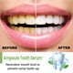 thumbnail image 5 of Esencia blanqueadora de dientes EELHOE, 5 of 10