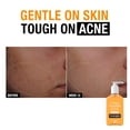 thumbnail image 4 of Limpiador facial Neutrogena, sin aceite, acné, 2% ácido salicílico, 270 ml, 4 of 9