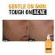thumbnail image 4 of Limpiador facial Neutrogena, sin aceite, acné, 2% ácido salicílico, 270 ml, 4 of 9