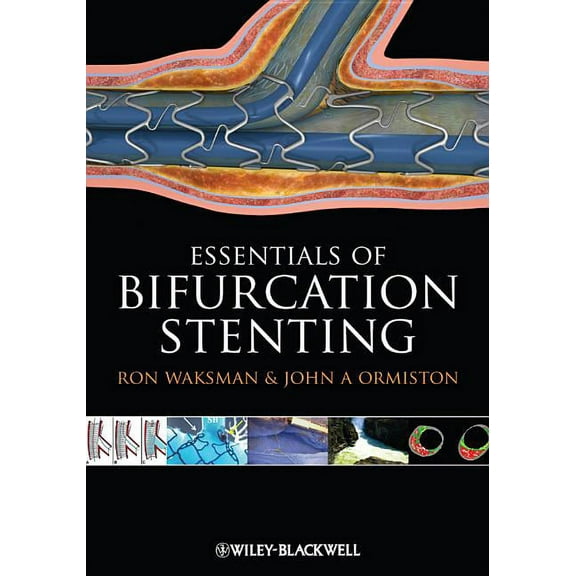 Bifurcation Stenting (Hardcover)