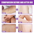 thumbnail image 4 of Scrubs Body Hair Removal Cleaning Smoothness Chicken Removal Dead Tender And White Exfoliating Cream 60g, 4 of 7