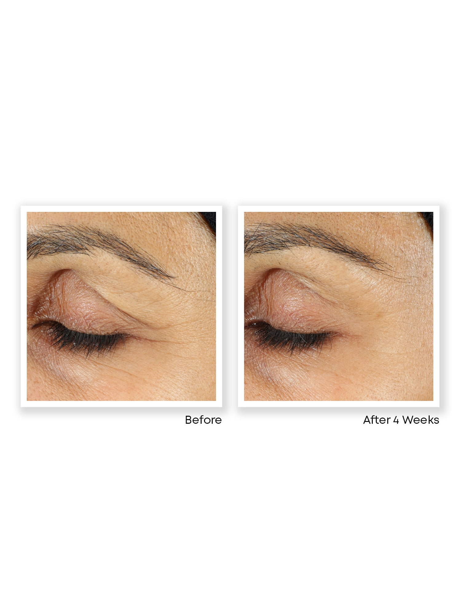 roc retinol eye cream walmart