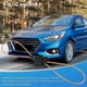 thumbnail image 5 of MOST Fiber Optic Loop Bypass MALE & FEMALE Kit Adapter for, 5 of 5