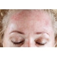 thumbnail image 4 of 2 Pack Lovelier Shea Butter Dandruff & Dermatitis Control Cream 4 oz total, 4 of 7