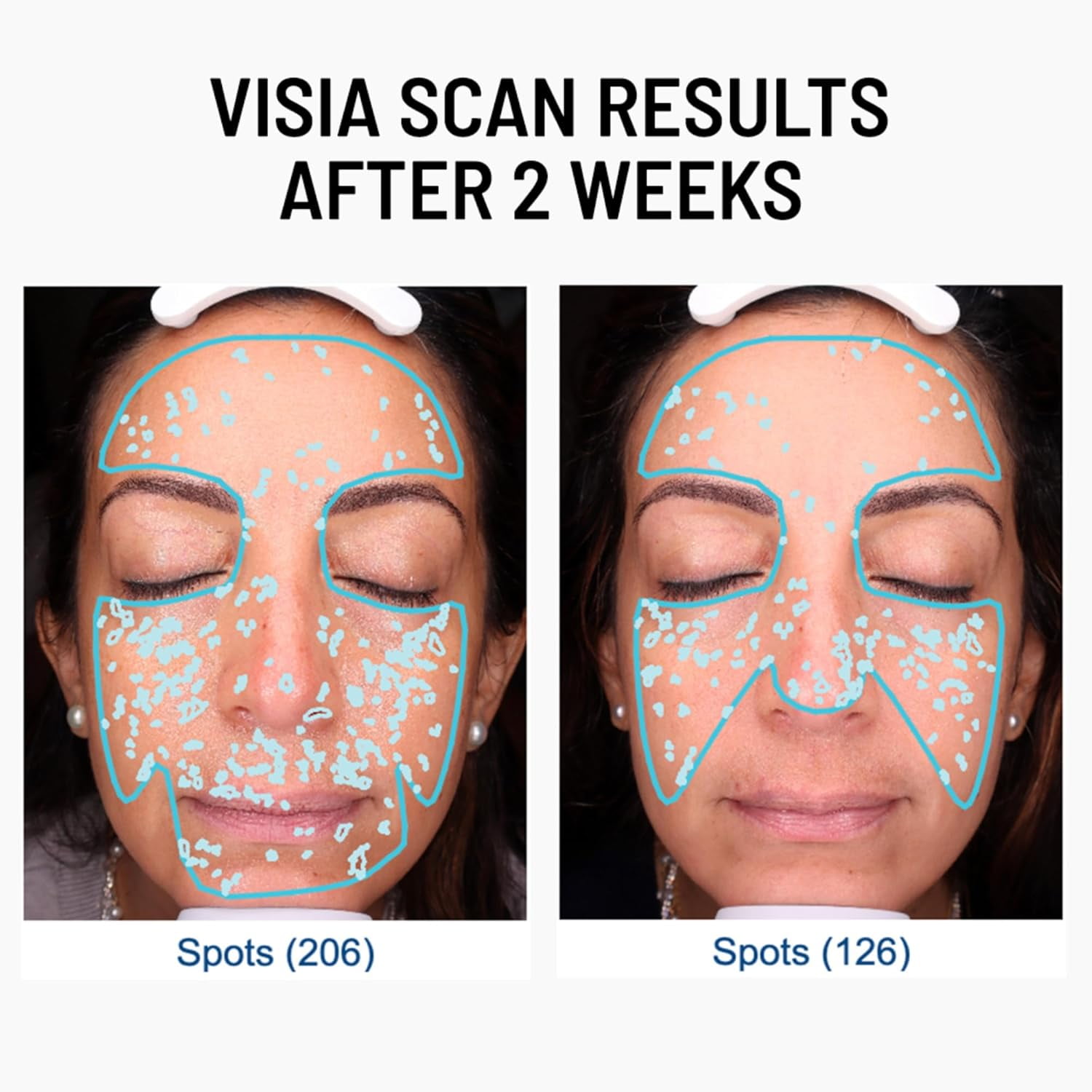 Dr. Brandt Advanced Microdermabrasion Face Exfoliator