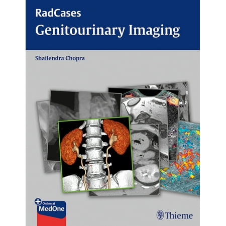 UPC: 9781604063240 | Radcases Plus Q&A: Radcases Genitourinary Imaging (Paperback)