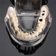 thumbnail image 4 of 2025 Modelos dentales Modelos de resina reparables de dientes enfermos para la enseñanza y la investigación en medicina y enfermedades dentales, 4 of 5