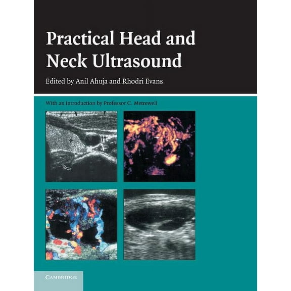 Practical Head & Neck Ultrasound, (Paperback)