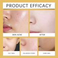 thumbnail image 4 of Niacinamide Exfoliant Face White Rice+black Rice Ampoule Skin Softening 30ml, 4 of 5