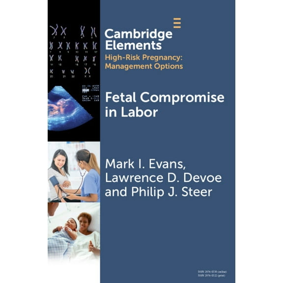 Elements in High Risk Pregnancy: Managem Fetal Compromise in Labor, (Paperback)