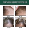 thumbnail image 4 of 3pcs Hair Growth Dense Spray Regrowth Essence Herbal Ginger Anti-loss Treatment Serum, 4 of 5