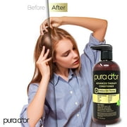 PURA DOR Advanced Therapy Biotin Conditioner 16 Fl Oz