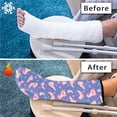 thumbnail image 7 of Jiueut Heart Axolotl Leg Cast Cover Leg Cast Cover for Showering Size M Cast Sleeve for Foot Leg Protector Strechable Below The Knee Leg Cast Sleeve Gifts for Friends, 7 of 7