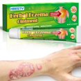 thumbnail image 1 of Crema para el cuidado de la piel,CAIXIN crema reparadora de sarpullidos 20g para aliviar la sequedad, el picor y las picaduras para hombres y mujeres, 1 of 6